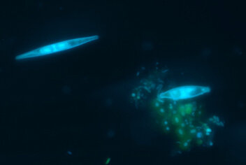 fluorescent microbes under the microscope made visible with FISH method
